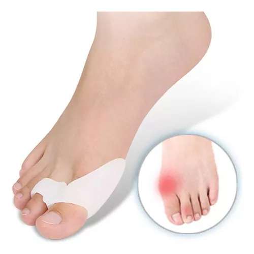 CORRECTOR DE JUANETES